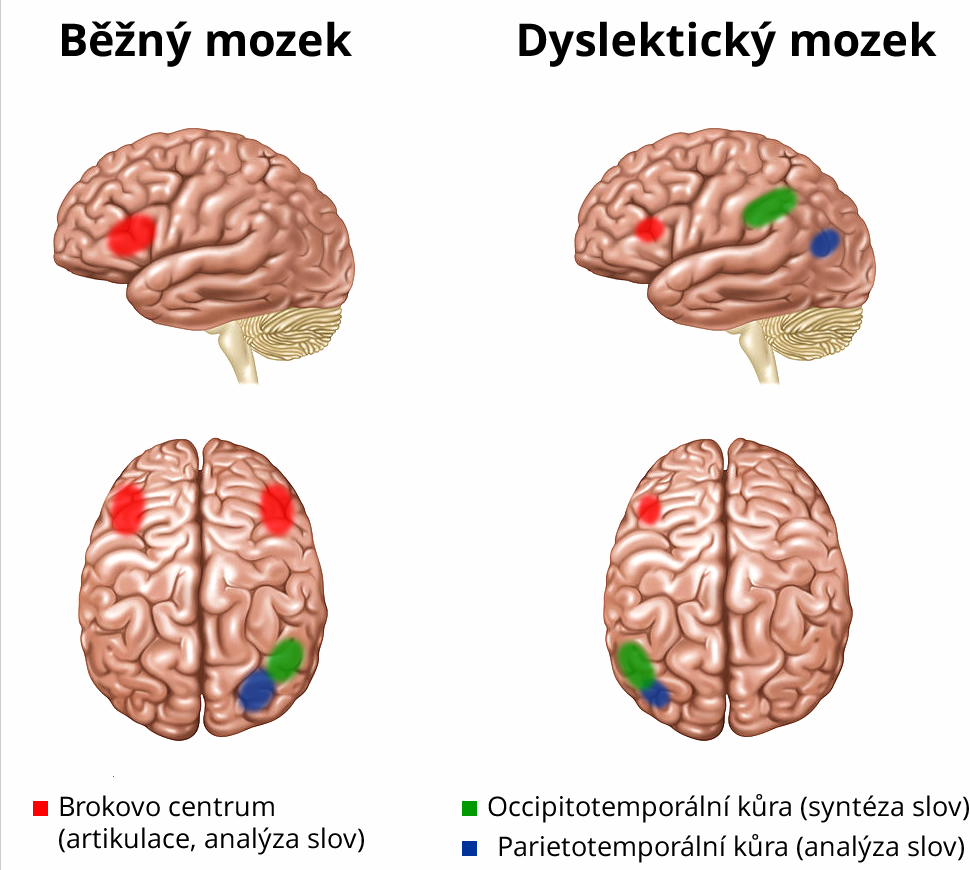 dyslexie03